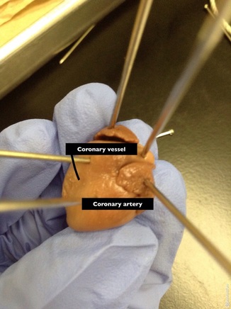 Circulatory System - Fetal Pig Dissection Lab